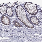 Immunohistochemical staining of human colon shows strong cytoplasmic granular positivity in glandular cells.
