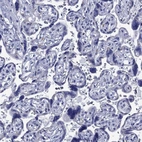 Immunohistochemical staining of human placenta shows no positivity in trophoblastic cells as expected.
