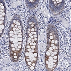 Immunohistochemical staining of human colon shows strong cytoplasmic granular positivity in glandular cells.
