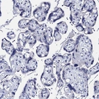 Immunohistochemical staining of human placenta shows no positivity in trophoblastic cells as expected.