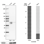 Western blot analysis in human cell lines A-431 and HeLa using Anti-ACADSB antibody. Corresponding ACADSB RNA-seq data are presented for the same cell lines. Loading control: Anti-PPIB.