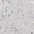 Immunohistochemical staining of human cerebral cortex shows weak cytoplasmic positivity in neurons.