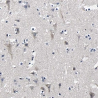 Immunohistochemical staining of human cerebral cortex shows weak cytoplasmic positivity in neurons.