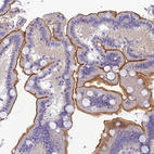 Immunohistochemical staining of human duodenum shows strong membranous positivity in glandular cells.