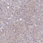 Immunohistochemical staining of human liver shows moderate membranous positivity in hepatocytes.