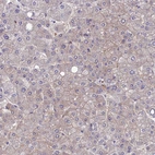 Immunohistochemical staining of human liver shows moderate membranous positivity in hepatocytes.