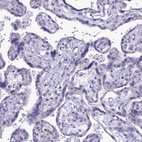 Immunohistochemical staining of human placenta shows no positivity in trophoblastic cells as expected.