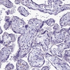 Immunohistochemical staining of human placenta shows no positivity in trophoblastic cells as expected.
