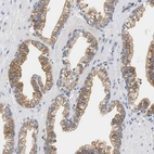 Immunohistochemical staining of human prostate shows moderate cytoplasmic positivity in glandular cells.