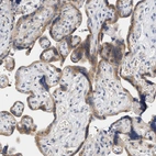 Immunohistochemical staining of human placenta shows moderate cytoplasmic positivity in trophoblastic cells.