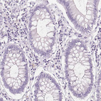Immunohistochemical staining of human colon shows no positivity in glandular cells as expected.
