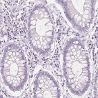 Immunohistochemical staining of human colon shows no positivity in glandular cells as expected.