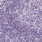 Immunohistochemical staining of human lymph node using Anti-EPHX1 antibody HPA048847.
