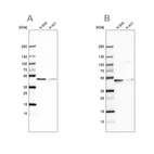 Western blot analysis using Anti-EPHX1 antibody HPA048847 (A) shows similar pattern to independent antibody HPA020593 (B).