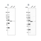 Western blot analysis using Anti-EPHX1 antibody HPA048847 (A) shows similar pattern to independent antibody HPA020593 (B).