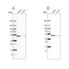 Western blot analysis using Anti-EPHX1 antibody HPA020593 (A) shows similar pattern to independent antibody HPA048847 (B).