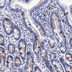Immunohistochemical staining of human duodenum shows strong cytoplasmic positivity in enteroendocrine cells.