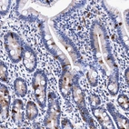 Immunohistochemical staining of human duodenum shows strong cytoplasmic positivity in enteroendocrine cells.