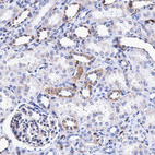Immunohistochemical staining of human kidney shows moderate cytoplasmic positivity in cells in tubules.