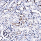 Immunohistochemical staining of human kidney shows moderate cytoplasmic positivity in cells in tubules.