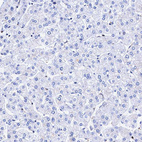 Immunohistochemical staining of human liver shows no positivity in hepatocytes as expected.