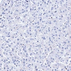Immunohistochemical staining of human liver shows no positivity in hepatocytes as expected.