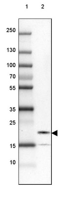 Lane 1: Marker [kDa] 250, 130, 100, 70, 55, 35, 25, 15, 10_br/_Lane 2: Human cell line SK-MEL-30