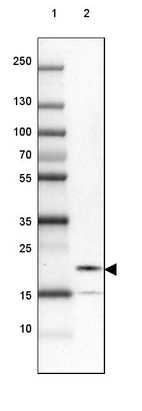 Lane 1: Marker [kDa] 250, 130, 100, 70, 55, 35, 25, 15, 10_br/_Lane 2: Human cell line SK-MEL-30