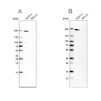 Anti-PBRM1 Antibody