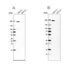 Anti-PBRM1 Antibody