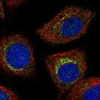 Immunofluorescent staining of human cell line A549 shows localization to the Golgi apparatus & vesicles.