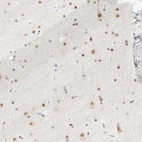 Immunohistochemical staining of human cerebral cortex shows strong nuclear positivity in neurons.