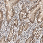 Immunohistochemical staining of human duodenum shows strong nuclear positivity in glandular cells.