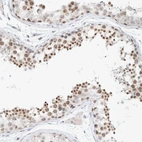 Immunohistochemical staining of human testis shows strong nuclear positivity in cells in seminiferous ducts.