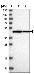 Lane 1: Marker [kDa] 230, 130, 95, 72, 56, 36, 28, 17, 11_br/_Lane 2: Human cell line RT-4_br/_Lane 3: Human cell line U-251MG sp