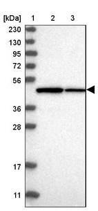 Lane 1: Marker [kDa] 230, 130, 95, 72, 56, 36, 28, 17, 11_br/_Lane 2: Human cell line RT-4_br/_Lane 3: Human cell line U-251MG sp