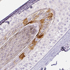 Immunohistochemical staining of human skin, hairy using Anti-RPTN antibody HPA030483.