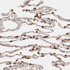 Immunohistochemical staining of human lung shows strong cytoplasmic positivity in macrophages.