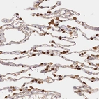 Immunohistochemical staining of human lung shows strong cytoplasmic positivity in macrophages.