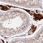 Immunohistochemical staining of human testis shows strong cytoplasmic positivity in Leydig cells.