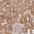 Immunohistochemical staining of human kidney shows strong cytoplasmic positivity in cells in tubules.