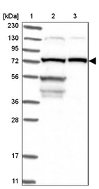 Lane 1: Marker [kDa] 230, 130, 95, 72, 56, 36, 28, 17, 11_br/_Lane 2: Human cell line RT-4_br/_Lane 3: Human cell line U-251MG sp
