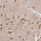 Immunohistochemical staining of human cerebral cortex shows strong cytoplasmic positivity in neurons.