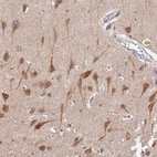 Immunohistochemical staining of human cerebral cortex shows strong cytoplasmic positivity in neurons.