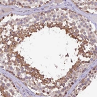 Immunohistochemical staining of human testis shows strong cytoplasmic positivity in spermatids.