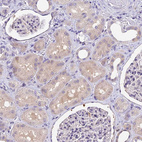 Immunohistochemical staining of human kidney shows moderate cytoplasmic positivity in cells in tubules.