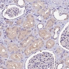 Immunohistochemical staining of human kidney shows moderate cytoplasmic positivity in cells in tubules.