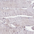 Immunohistochemical staining of human skeletal muscle shows no positivity in myocytes as expected.