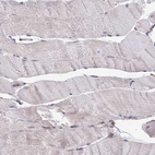 Immunohistochemical staining of human skeletal muscle shows no positivity in myocytes as expected.