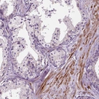 Immunohistochemical staining of human prostate shows moderate cytoplasmic positivity in smooth muscle cells.